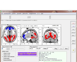 LORETA-KEY Viewer